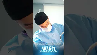 Dr. Moradian performed this Breast Augmentation! 🔥 l Avana Plastic Surgery