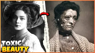 Toxic Beauty Tricks in the Victorian Era