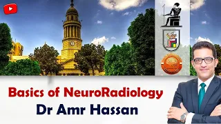 Basics of NeuroRadiology-أ.د. عمرو حسن الحسني