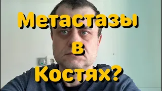 Рак Желудка - В Больнице. Метастазы в Костях и Мозге? Ухудшение моего состояния.