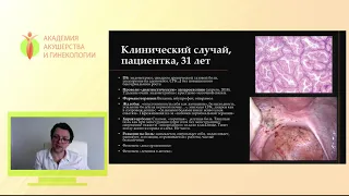 Когнитивно-поведенческая психотерапия при эндометриозе