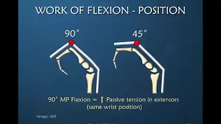 Nuances of Flexor Tendon Rehab: Part 8 of 12: WOF; Position in Orthosis