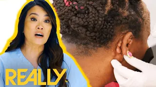 Dr Lee Removes Numerous Growths From Sisters' Faces! l Dr. Pimple Popper