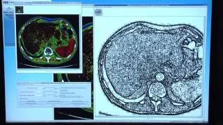 NASA | NASA Aids in Medical Imaging