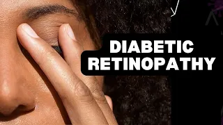 Diabetic Retinopathy Symptoms and Treatment