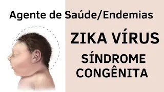 Síndrome Congênita Associada ao Zika Vírus - Agente de Saúde e Agente de Endemias