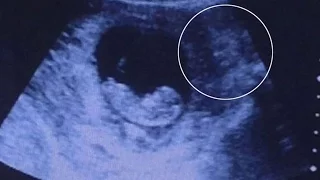 Scary Picture Shows Demon Watching Over Baby In Ultrasound