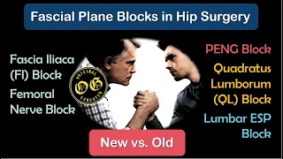 Which Fascial Plane Blocks in Hip Surgery? (2022)