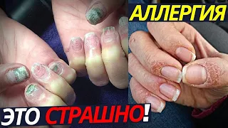 ЭТО СТРАШНО! Аллергия на ногтях | Маникюр и гель лак