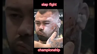 Swelling Face😢 SLAP FIGHT CHAMPIONSHIP