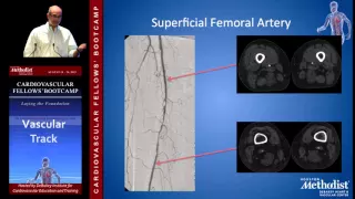 Lower Extremity Anatomy (Charudatta Bavare, MD)