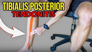 3 Exercises for Tibialis Posterior Tendonitis