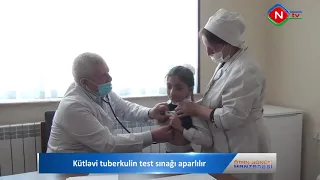 Kütləvi tuberkulin test sınağı aparılır.