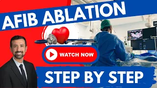 AFib Ablation Made Easy: Expert Consultation Guide