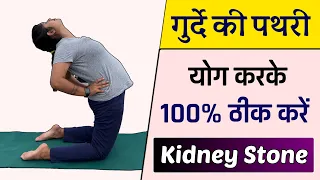 गुर्दे की पथरी को ठीक करने के लिए योग आसन | Yoga for Kidney Stone Pain Relief | @Yogawale