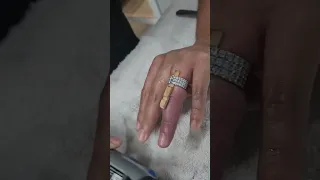 I cut off my own diamond wedding ring with a dremel.