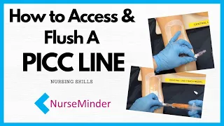 How To Flush a PICC line (peripherally inserted central catheter)