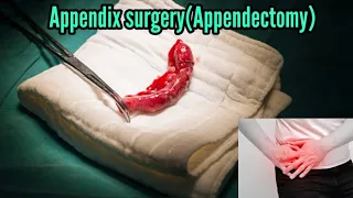 How does Appendectomy works?| Appendicitis symptoms & treatment (Urdu/hindi)