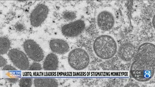 Health department, LGBTQ activists warn against stigmatizing monkeypox