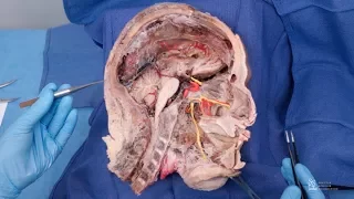 Anatomy Series - Trigeminal Nerve