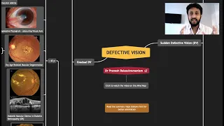 Defective Vision - Master the Differential Diagnoses with Mind Map