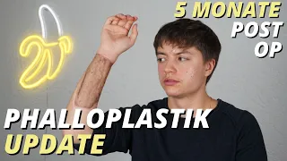 5 Monate post Op - Phalloplastik/Penisaufbau - ftm transgender