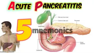 acute pancreatitis, causes, signs and symptoms, pathophysiology, investigations, treatment)