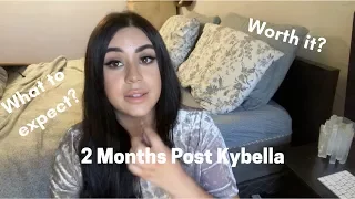 2 Months Post Kybella | What is the KYBELLA experience like?