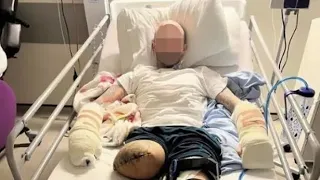 Drugs gang send a brutal message cutting off man’s leg, fingers and partners fingers.