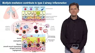 Bench to Bedside: Asthma Heterogeneity, Part 2 - Joseph Arron