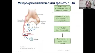 Управление болью: междисциплинарный подход - 2020-05-22