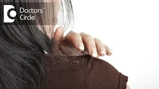 Is continuous use of medications necessary for managing severe dandruff? - Dr. Nischal K