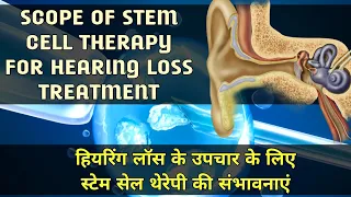 STEM CELL THERAPY | HEARING LOSS TREATMENT