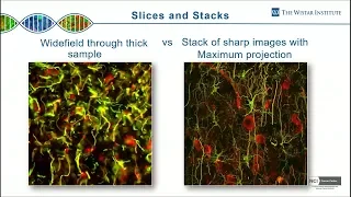 James Hayden -  2-Photon Microscopy: How Deep Can You Go? Part 1