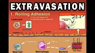 EXTRAVASATION