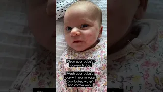 Breast Milk cures Baby Acne 🤯 #shorts #baby #babygirl