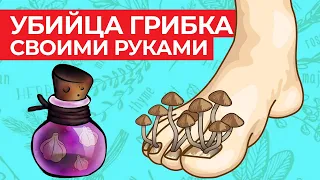 Убираем грибок с ногтей в домашних условиях  Как вылечить грибок народными средствами?