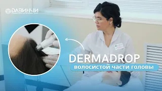 DERMADROP | Безинъекционная мезотерапия кожи головы