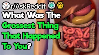 What Is The Most Disgusting Thing That Has Ever Happened To You?