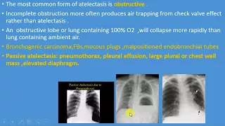 week12 radiological findings on CXR