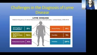 Early Signs and Symptoms of Lyme Disease