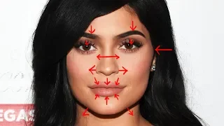 Removing KYLIE JENNER'S Plastic Surgery