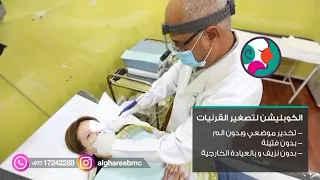 الكوبليشن لتصغير القرنيات الانفية