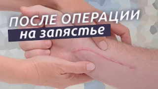 Реабилитация запястья. Что делать после операции на запястье?