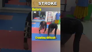 Revitalizing Stroke Recovery  Advanced Cellular Therapy Boosts Crawling in Karnataka