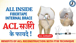 3: ALL INSIDE ACL RECONSTRUCTION with FIBER TAPE INTERNAL BRACE, Dr Manu Bora www.orthosport.in