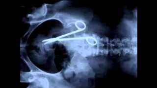 Top 10 Weird Things Found In X-Rays