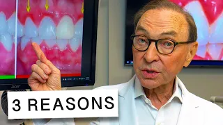 3 Reasons Why Your Gums Are Inflamed 🦷🔥 | How to Treat at Home