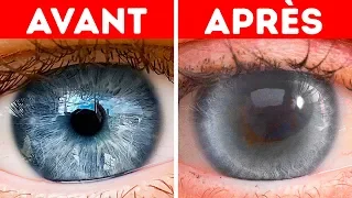 Que se Passerait-il Si tu ne Clignais Pas Des Yeux Pendant 30 Jours ?