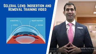 Scleral Lens Insertion and Removal Training Video